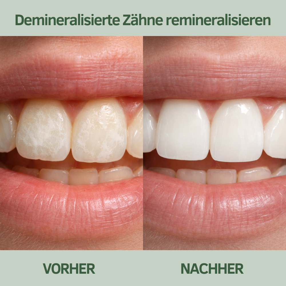 Baumkau Produktinformation 6